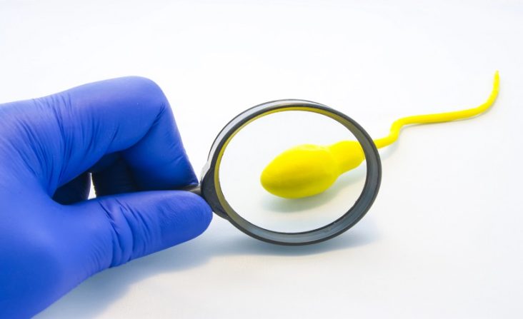 How long does a vasectomy take from start to finish explained